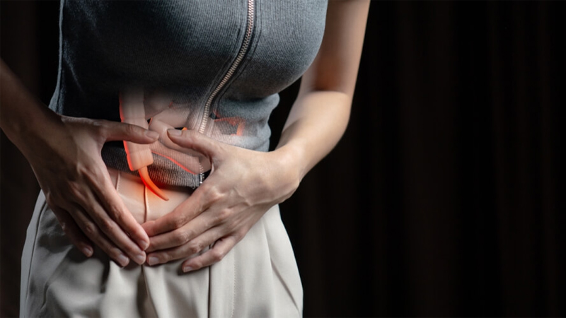 التهاب الزائدة الدودية